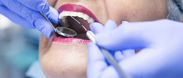 Best Emergency Broken Tooth Repair in Miami, FL